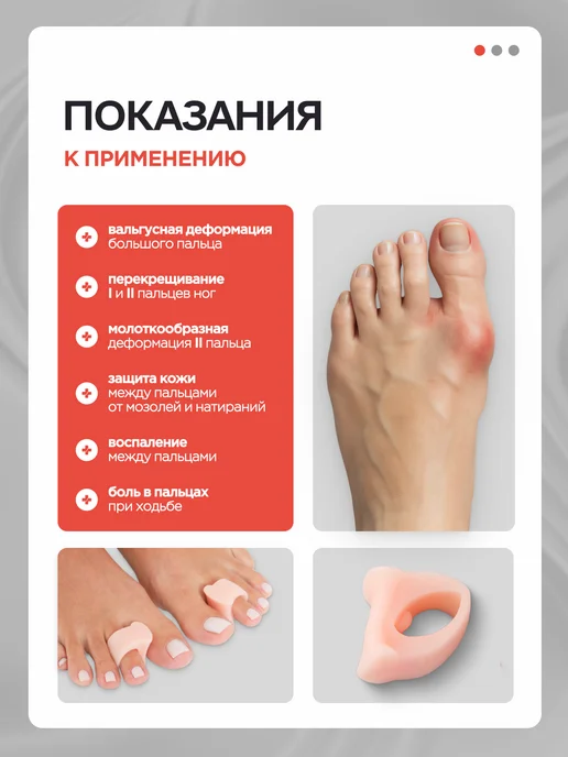 MEDKING Разделитель пальцев ног ортопедический вальгусный корректор, бежевый, фото 2