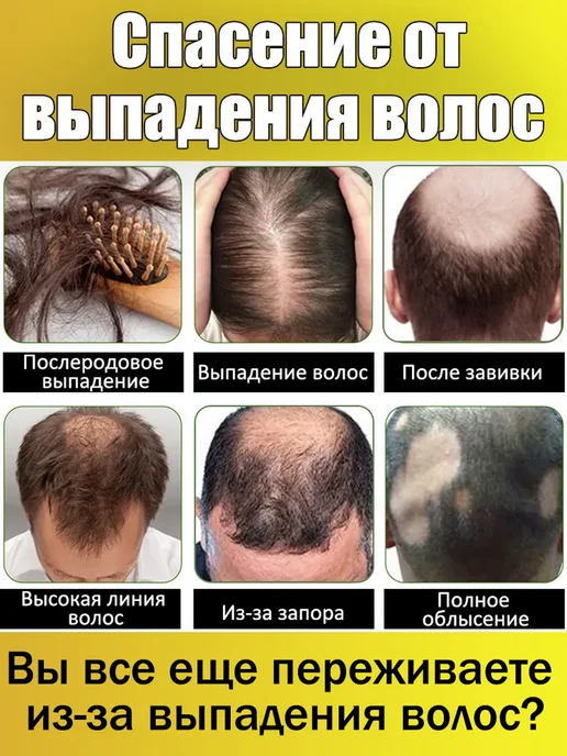 LYDIMOON Шампунь для роста волос и от выпадения 500мл, 500 мл, фото 2