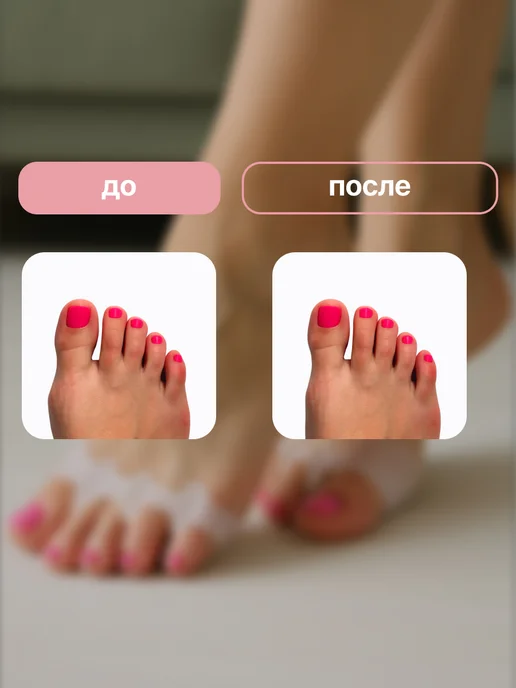 Shark Fit Разделитель корректор для пальцев ног силиконовый 2шт, 2 шт, фото 5