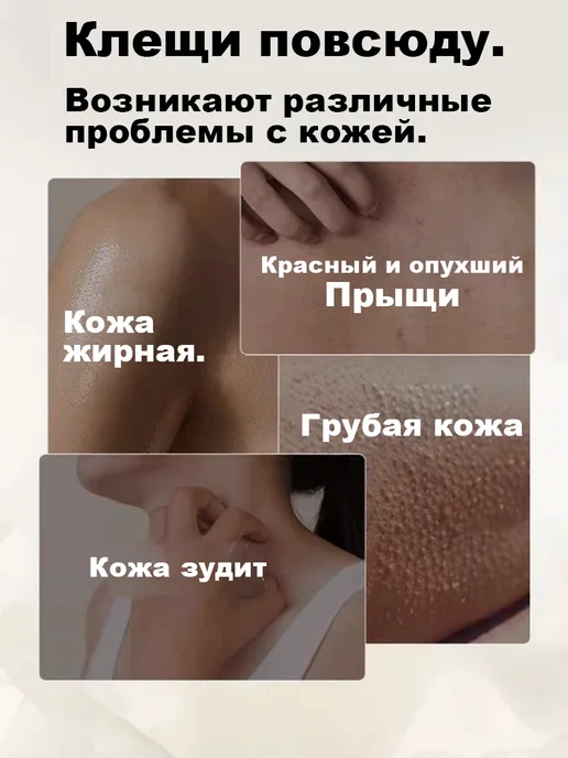 Очищающий гель для душа с серой от прыщей и клещей, 300 мл, фото 2