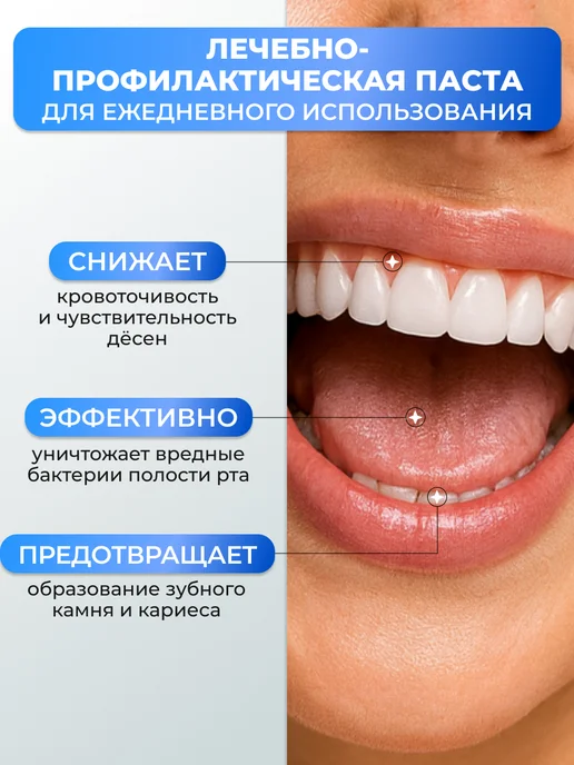 Lion Зубная паста отбеливающая от кариеса и налёта Systema, 1 шт, 1 шт, фото 3
