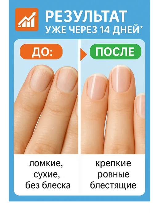 aikanya13 Ланбена, гель для удаления кутикулы объем 20 г, 20 г, фото 3