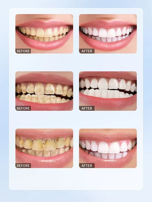 LYDIMOON Biorepair зубная паста 120 г, 120 г, фото 4