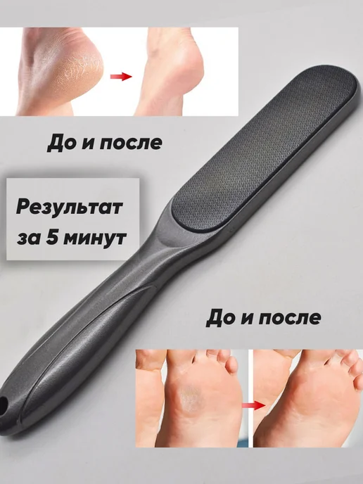 Lady Kuss Нано пемза терка для пяток и ног с ручкой профессиональная, серый, фото 7