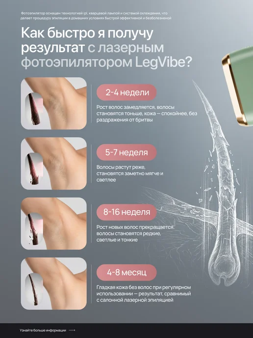 LegVibe Фотоэпилятор лазерный профессиональный для удаления волос, зеленый, фото 2