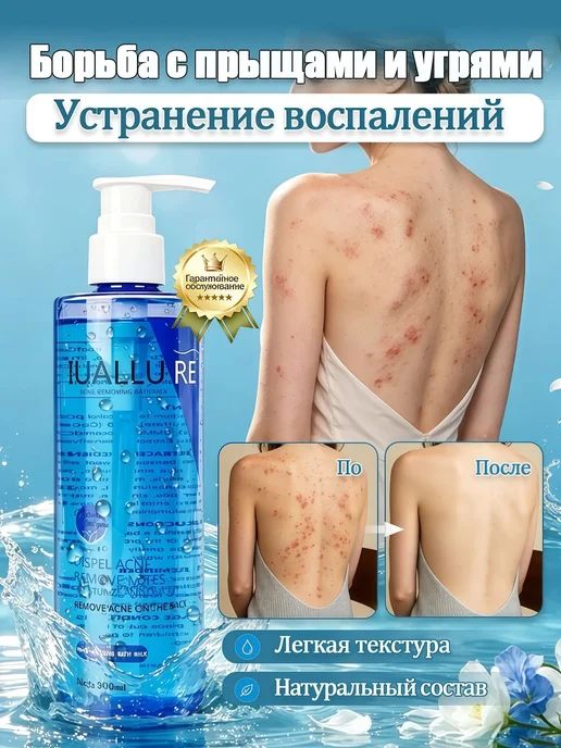 IUALLURE Гель для душа от прыщей, антибактериальный и противозудный, 300 мл, фото 2