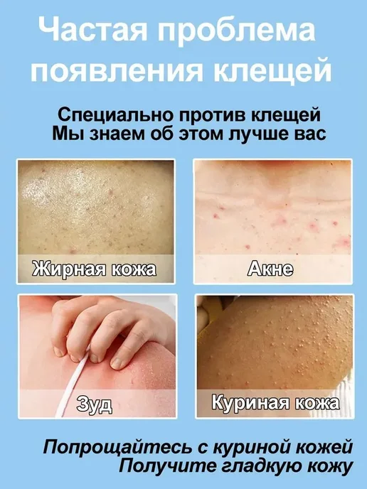 IUALLURE Гель для душа от прыщей, антибактериальный и противозудный, 300 мл, фото 4
