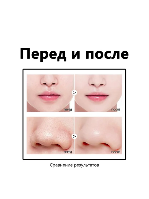 West&Month 2 шт. Маска для удаления черных точек, 2 шт, фото 7