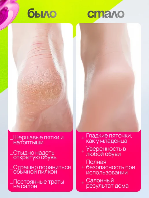 Находочка Пемза для пяток нано терка и пилки для ногтей набор 3 в 1, белый, фото 4